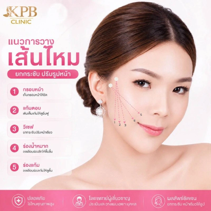 แนวการวางเส้นไหม KPB Clinic